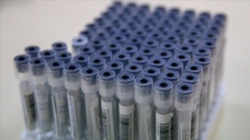 KKTC'ye girişlerde 1 Mart itibarıyla tam aşılılardan Kovid-19 testi istenmeyecek